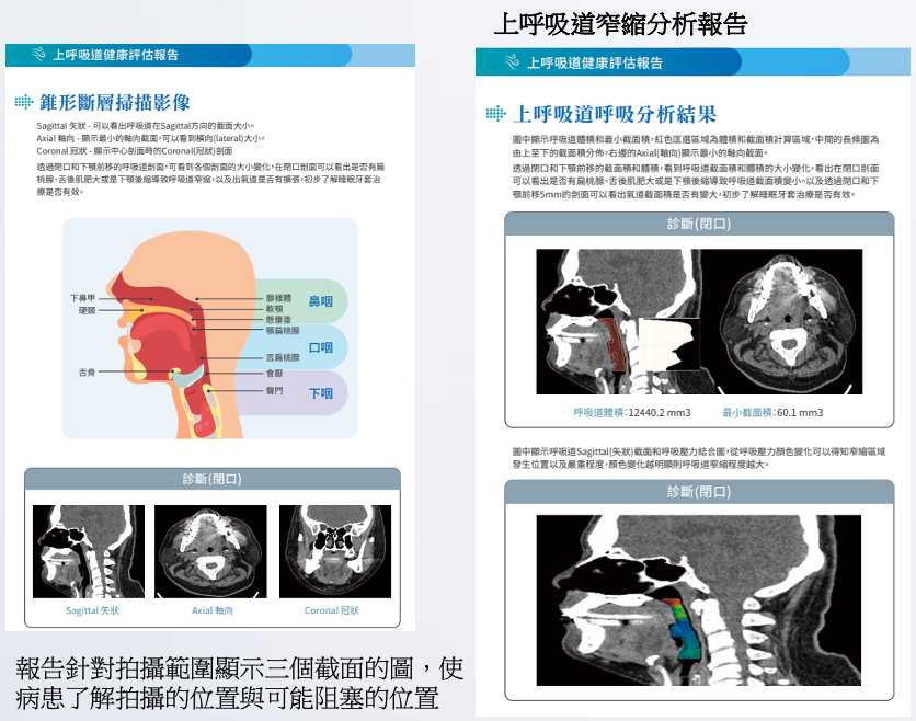 上呼吸道窄縮分析系統